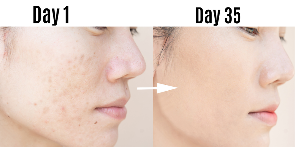 Kinoil – Pure Chulli For Face & Body