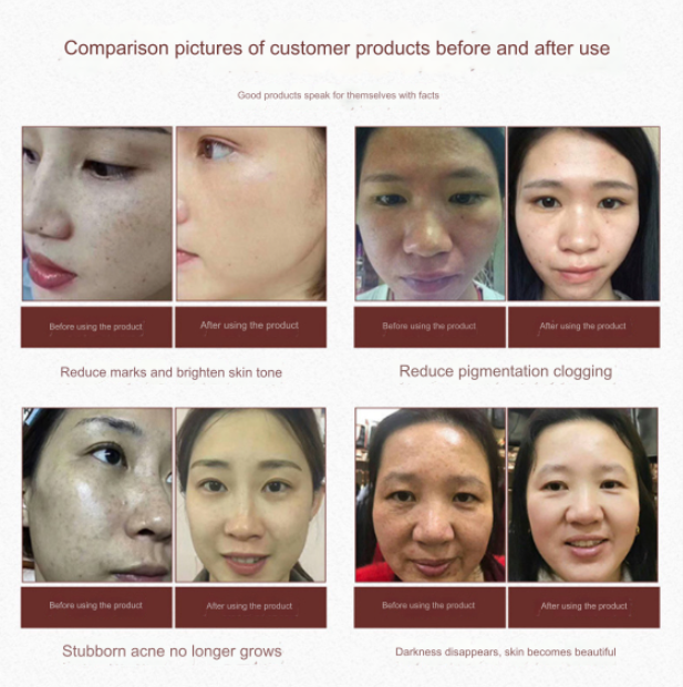 Herbal Self-Adjusting Freckle Mask Powder