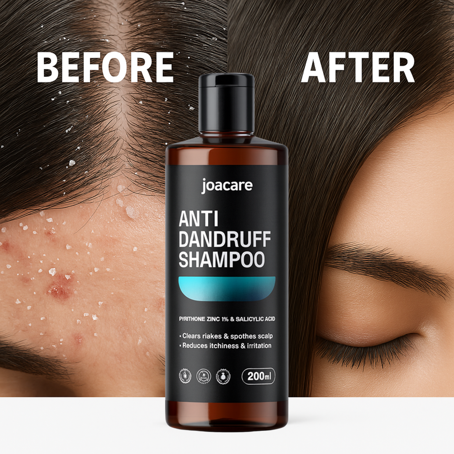 Anti-Dandruff Shampoo – pH Balanced · Gentle · Effective