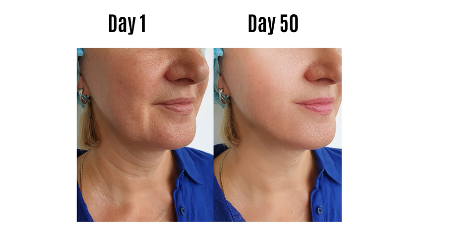 Kinoil – Pure Chulli For Face & Body